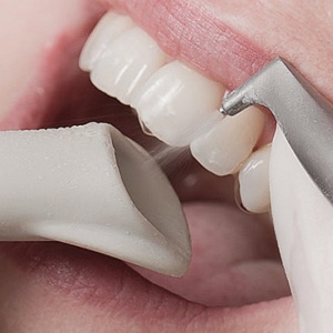 Качественная чистка зубов в Махачкале доступна всем в «Стоматологии 32»